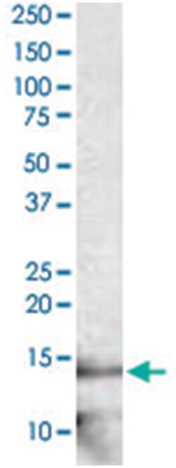 IL21 Rabbit anti-Bovine, Horse, Pig, Polyclonal Antibody, Abnova 100 &mu;g | Buy Online | Abnova | Fisher Scientific