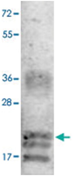 VEGFA Rabbit anti-Bovine, Polyclonal Antibody, Abnova 100 &mu;g | Buy Online | Abnova | Fisher Scientific