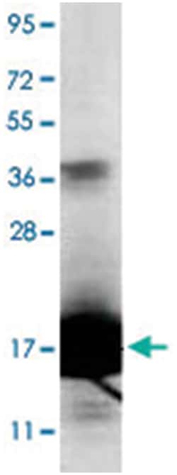 IL1F5, Rabbit, Polyclonal Antibody, Abnova 100&mu;g; Unlabeled:Antibodies,