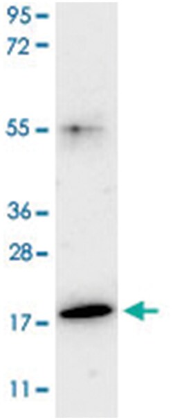 IL17F Rabbit anti-Mouse, Rat, Polyclonal Antibody, Abnova 100&mu;g; Unlabeled:Antibodies,