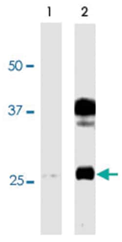 Aqp2 (phospho S264), Rabbit, Polyclonal Antibody, Abnova 100 &mu;L | Buy Online | Abnova | Fisher Scientific