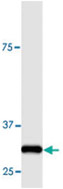 Actin (32kDa fragment), Rabbit, Polyclonal Antibody, Abnova™