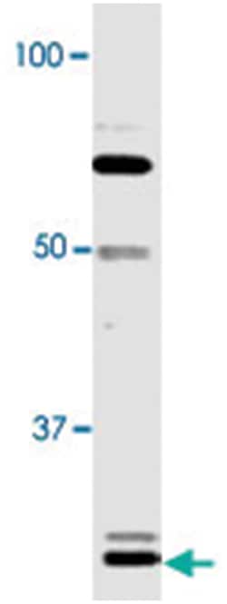 Olig1, Rabbit, Polyclonal Antibody, Abnova 100&mu;L; Unlabeled:Antibodies,