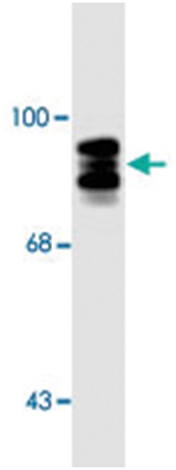 Postn Rabbit anti-Chicken, Human, Mouse, Rat, Polyclonal Antibody, Abnova 50 &mu;L | Buy Online | Abnova Corporation | Fisher Scientific