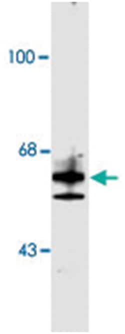 Nr2c1, Rabbit, Polyclonal Antibody, Abnova 100 &mu;L | Buy Online | Abnova | Fisher Scientific