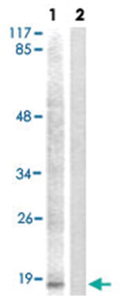 HIST1H3E (phospho S28), Rabbit anti-Human, Mouse, Rat, Polyclonal Antibody,