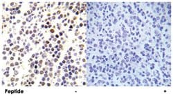 HIST1H3E (phospho S28), Rabbit anti-Human, Mouse, Rat, Polyclonal Antibody,