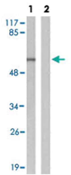 TP53 (phospho S20), Rabbit anti-Human, Mouse, Polyclonal Antibody, Abnova