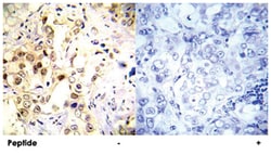 TP53 (phospho S20), Rabbit anti-Human, Mouse, Polyclonal Antibody, Abnova