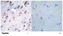 PDGFRB (phospho Y751), Rabbit anti-Human, Mouse, Rat, Polyclonal Antibody, Abnova 100 &mu;g | Buy Online | Abnova Corporation | Fisher Scientific
