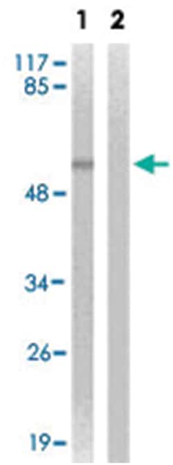 HDAC1 (phospho S421/S423), Rabbit anti-Human, Mouse, Rat, Polyclonal Antibody,