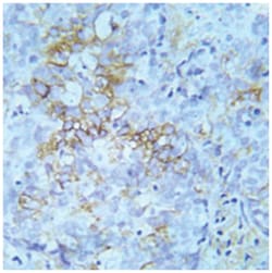 IGF1R (phospho Y980), Rabbit anti-Human, Mouse, Rat, Polyclonal Antibody, Abnova 100 &mu;g | Buy Online | Abnova Corporation | Fisher Scientific
