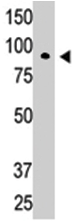 CBLC Rabbit anti-Human, Polyclonal Antibody, Abnova 400&mu;L; Unlabeled:Antibodies,
