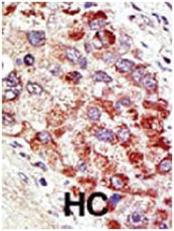 CBLC Rabbit anti-Human, Polyclonal Antibody, Abnova 400&mu;L; Unlabeled:Antibodies,