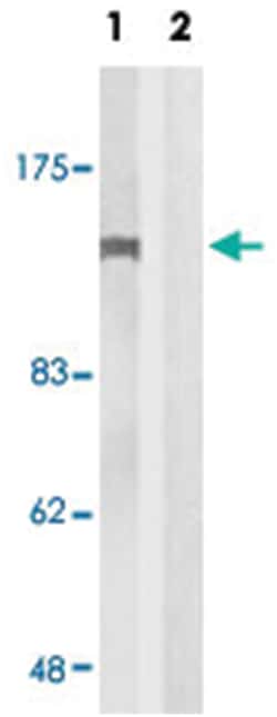 ABL1 Rabbit anti-Human, Mouse, Rat, Polyclonal Antibody, Abnova 100&mu;g;