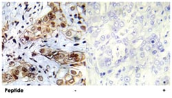 ABL1 Rabbit anti-Human, Mouse, Rat, Polyclonal Antibody, Abnova 100&mu;g;