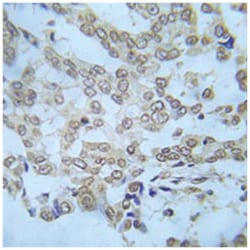 IKK-alpha/beta Rabbit anti-Human, Mouse, Rat, Polyclonal Antibody, Abnova