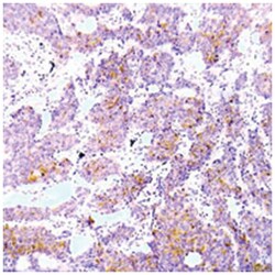 ALK (phospho Y1586), Rabbit anti-Human, Polyclonal Antibody, Abnova 100 &mu;g | Buy Online | Abnova Corporation | Fisher Scientific