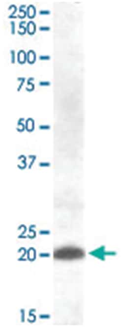 CLEC4C, Goat, Polyclonal Antibody, Abnova 100&mu;g; Unlabeled:Antibodies,