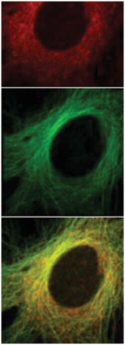 ch-TOG, Rabbit, Polyclonal Antibody, Abnova 100 &mu;L | Buy Online | Abnova Corporation | Fisher Scientific