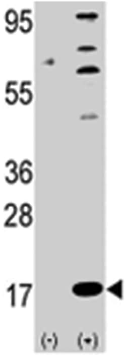 FAU Rabbit anti-Human, Polyclonal Antibody, Abnova 400&mu;L; Unlabeled:Antibodies,
