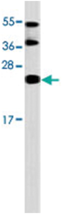 ISG15 Rabbit anti-Human, Polyclonal Antibody, Abnova 400&mu;L; Unlabeled:Anticuerpos