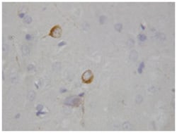 NOS1 Rabbit anti-Human, Rat, Polyclonal Antibody, Abnova 100&mu;g; Unlabeled:Antibodies,