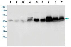 SMAD1/SMAD2/SMAD3/SMAD5, Rabbit, Polyclonal Antibody, Abnova 100 &mu;g | Buy Online | Abnova Corporation | Fisher Scientific