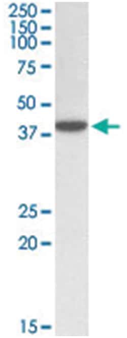 ERLIN1, Goat, Polyclonal Antibody, Abnova 100&mu;g; Unlabeled:Antibodies,