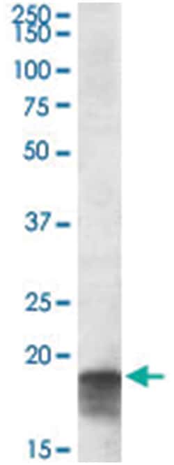 LOC644096, Goat, Polyclonal Antibody, Abnova 100&mu;g; Unlabeled:Antibodies,