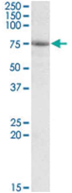 AARSD1, Goat, Polyclonal Antibody, Abnova 100&mu;g; Unlabeled:Antibodies,