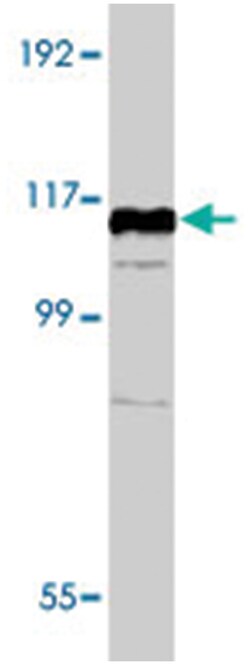 MIB1, Rabbit, Polyclonal Antibody, Abnova 400&mu;L; Unlabeled:Antibodies,
