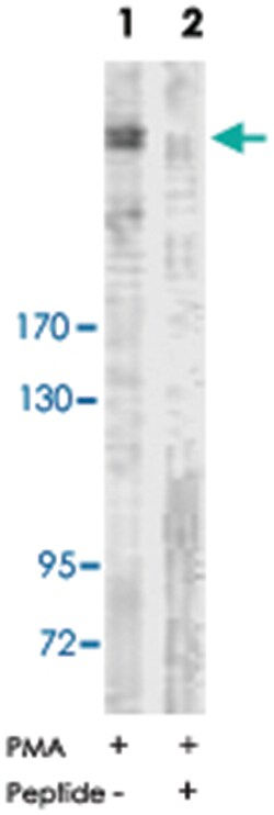 ACACA Rabbit anti-Human, Mouse, Rat, Polyclonal Antibody, Abnova 100&mu;g;