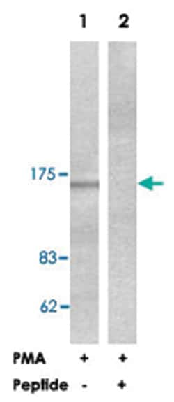 PLCB3 Rabbit anti-Human, Mouse, Rat, Polyclonal Antibody, Abnova 100&mu;g;