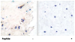 PLCB3 Rabbit anti-Human, Mouse, Rat, Polyclonal Antibody, Abnova 100&mu;g;
