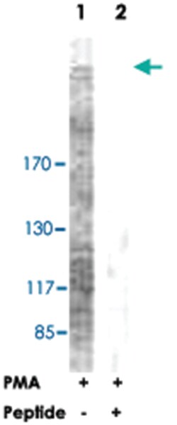 ACACA Rabbit anti-Human, Mouse, Rat, Polyclonal Antibody, Abnova 100&mu;g;