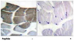 ACACA Rabbit anti-Human, Mouse, Rat, Polyclonal Antibody, Abnova 100&mu;g;