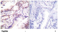RBBP8 Rabbit anti-Human, Mouse, Polyclonal Antibody, Abnova 100&mu;g; Unlabeled:Antibodies,