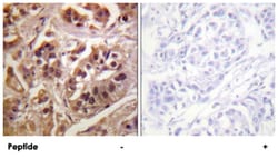 GRLF1, Rabbit, Polyclonal Antibody, Abnova 100&mu;g; Unlabeled:Antibodies,