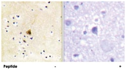 RYR2, Rabbit, Polyclonal Antibody, Abnova 100&mu;g; Unlabeled:Antibodies,