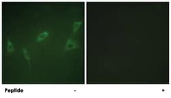 RYR2, Rabbit, Polyclonal Antibody, Abnova 100&mu;g; Unlabeled:Antibodies,