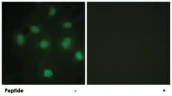 TLK1 Rabbit anti-Human, Mouse, Polyclonal Antibody, Abnova 100 &mu;g | Buy Online | Abnova Corporation | Fisher Scientific