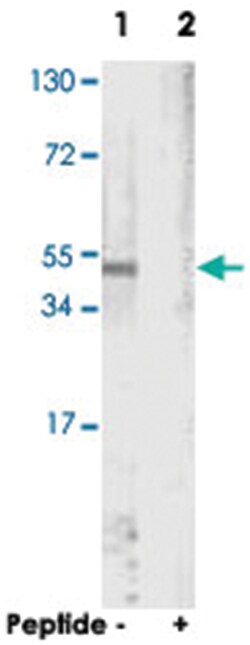 Actin-pan, Rabbit, Polyclonal Antibody, Abnova 100&mu;g; Unlabeled:Antibodies,