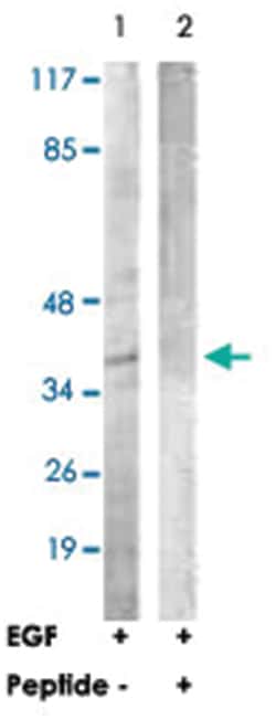 CEBPA Rabbit anti-Human, Mouse, Rat, Polyclonal Antibody, Abnova 100 &mu;g | Buy Online | Abnova Corporation | Fisher Scientific