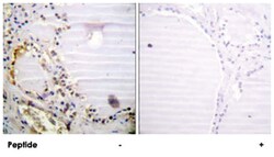 RBBP8 Rabbit anti-Human, Mouse, Polyclonal Antibody, Abnova 100&mu;g; Unlabeled:Antibodies,