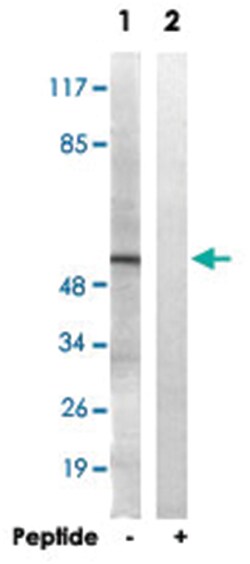 APLF, Rabbit, Polyclonal Antibody, Abnova 100&mu;g; Unlabeled:Antibodies,