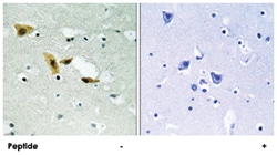 APLF, Rabbit, Polyclonal Antibody, Abnova 100&mu;g; Unlabeled:Antibodies,