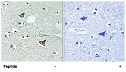 CCDC88A Rabbit anti-Human, Mouse, Polyclonal Antibody, Abnova 100 &mu;g | Buy Online | Abnova | Fisher Scientific