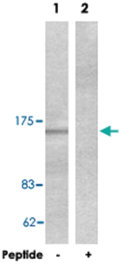 COL4A1 Rabbit anti-Human, Mouse, Polyclonal Antibody, Abnova 100&mu;g;