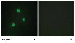 TBX1 Rabbit anti-Human, Polyclonal Antibody, Abnova 100&mu;g; Unlabeled:Antibodies,